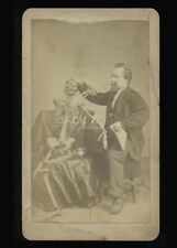 Rare CDV Photo Man / Doctor Taking Temperature of Human Skeleton Antiques 1800s picture