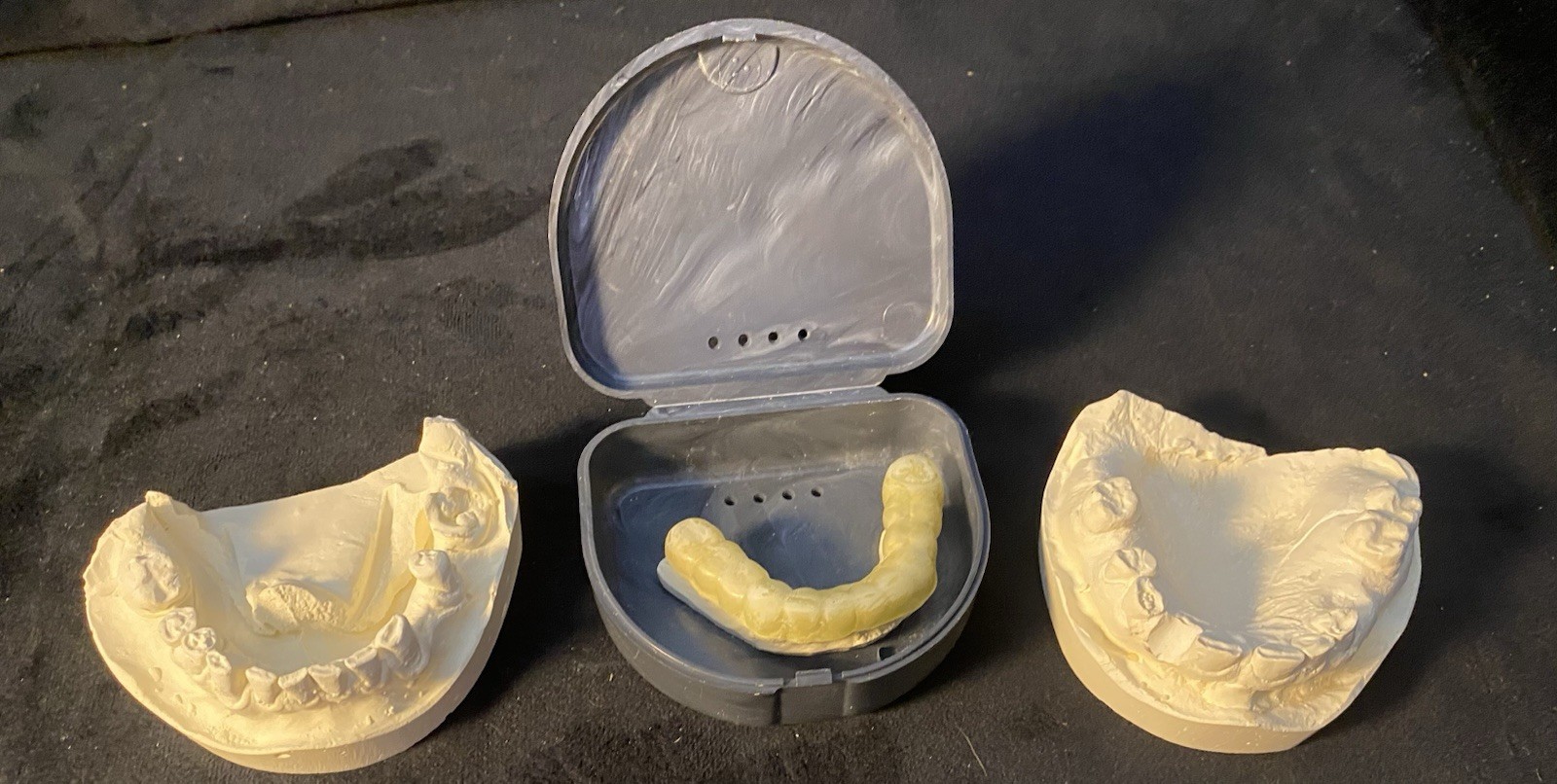 Three (3) Vintage Plaster Dental Molds TEETH Dentist Tooth Impressions ODDITIES