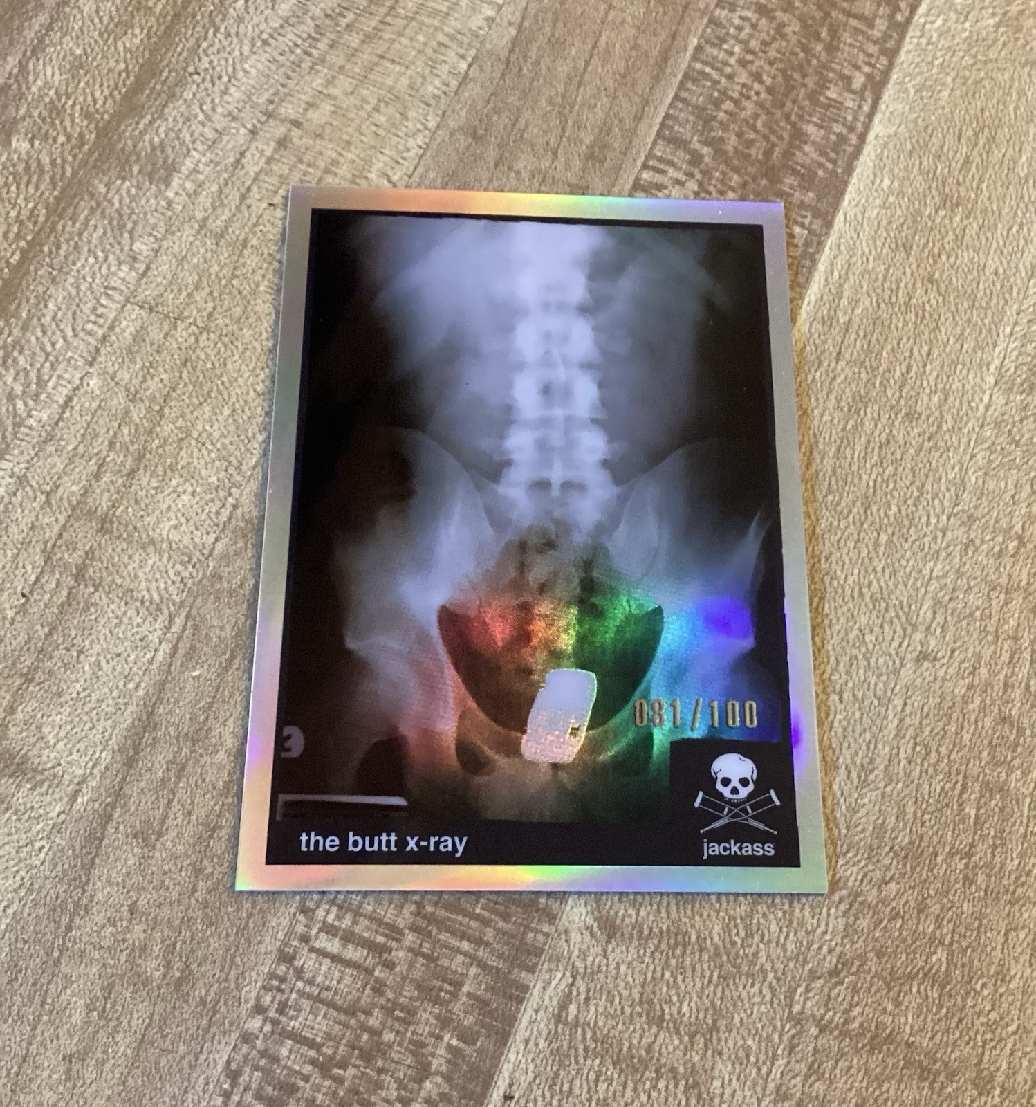 2022 ZEROCOOL JACKASS CARD STUNTS #s-3 THE BUTT X-RAY SILVER HOLO /100 RYAN DUNN 2022 ZEROCOOL JACKASS CARD STUNTS #s-3 THE BUTT X-RAY SILVER HOLO /100 RYAN DUNN