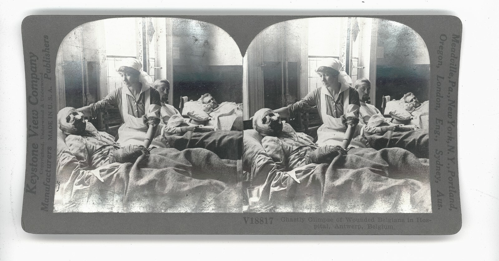  Stereoscope Stereo View Real Photo Card WW1 Horror Of War Glimpse Of Wounded