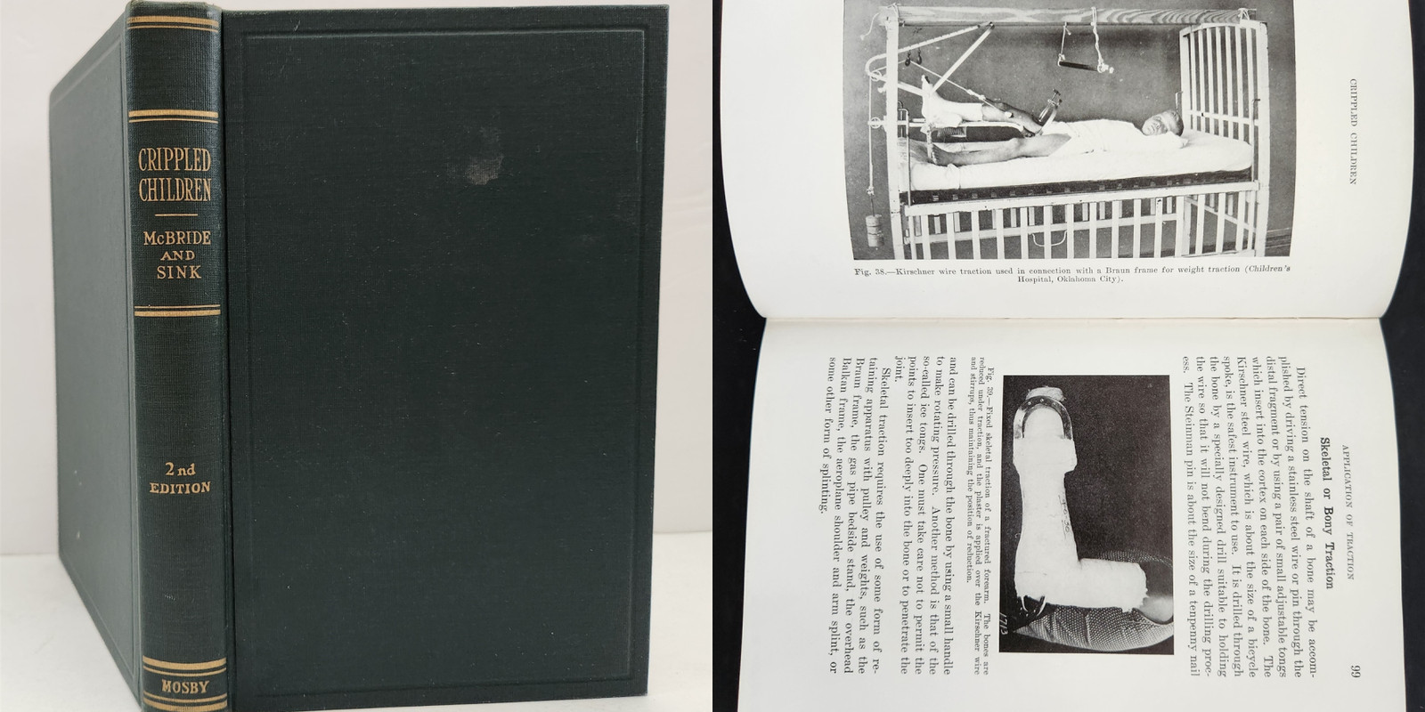 1939 antique CRIPPLED CHILDREN TREATMENT medical orthopedic nursing book