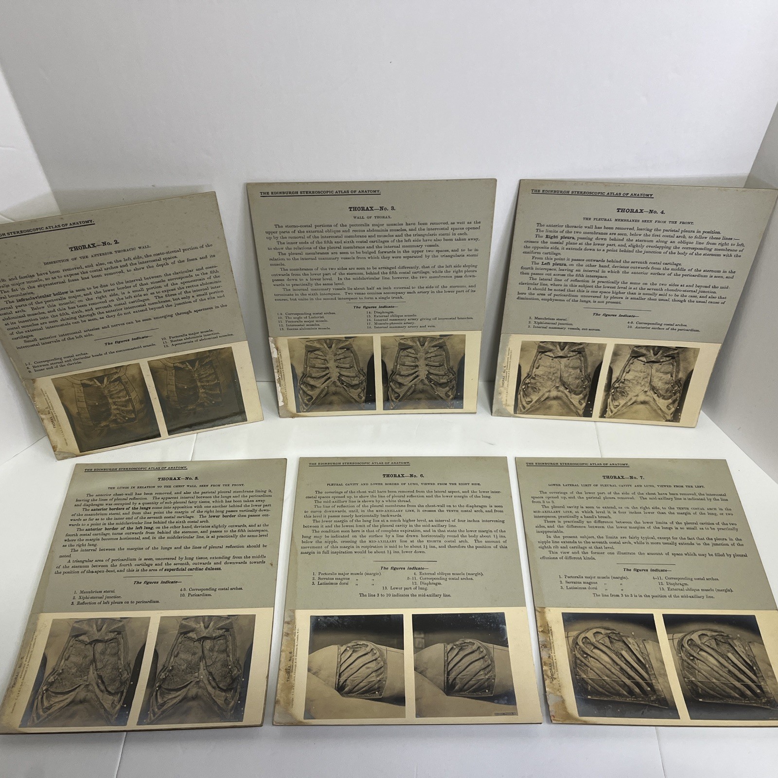 Edinburgh Stereoscopic Atlas Of Antony Cards Set Of 20 Thorax & Mediastina