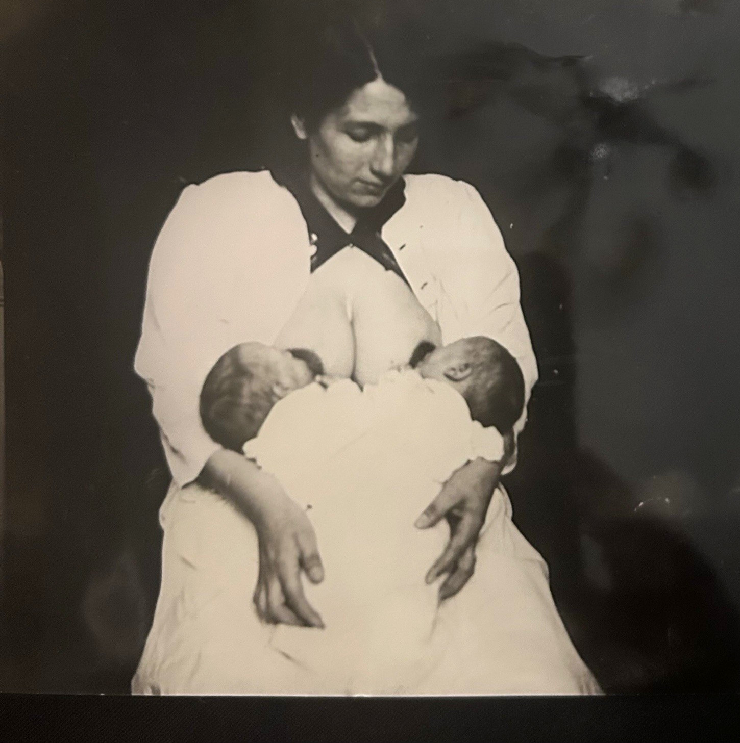 1921 Vintage Copy Photo Suzanne Madeleine Conjoined Twins Xiphopagus France 1921 Vintage Copy Photo Suzanne Madeleine Conjoined Twins Xiphopagus France