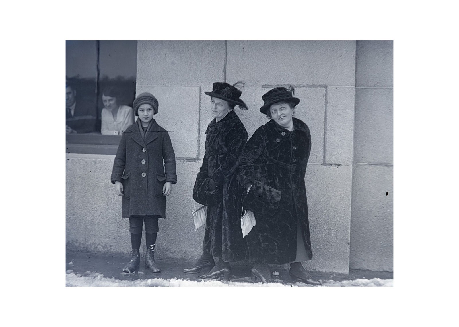 1921 Conjoined Bohemian Twins Rosa Josepha Blazek Original Press Glass Negative