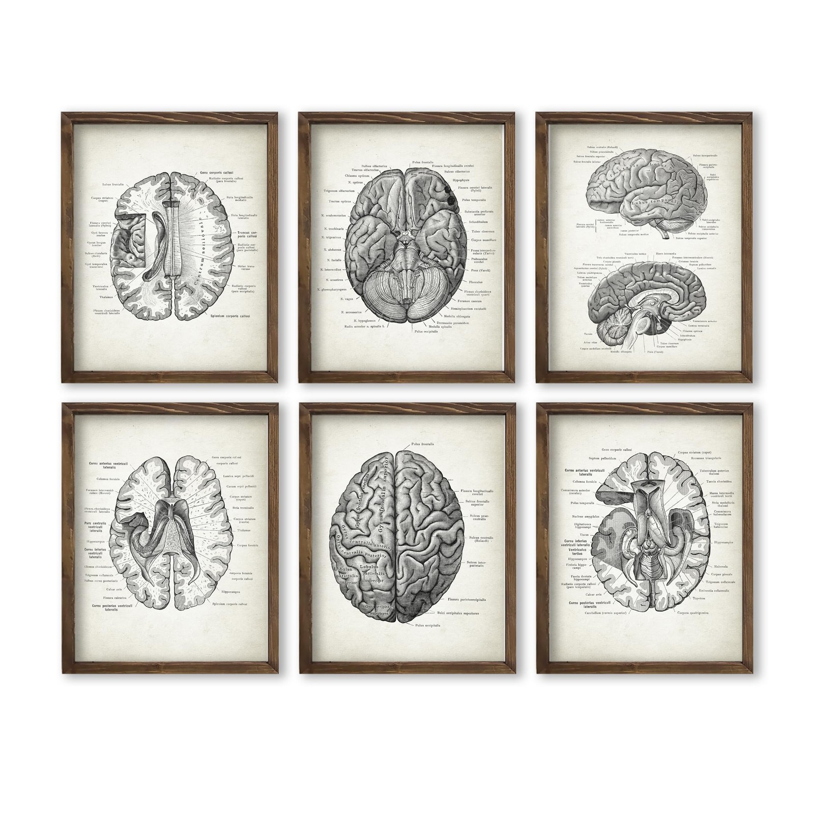 Vintage Human Brain Anatomy Wall Art Print Set of 6, 8x10 Inch Unframed