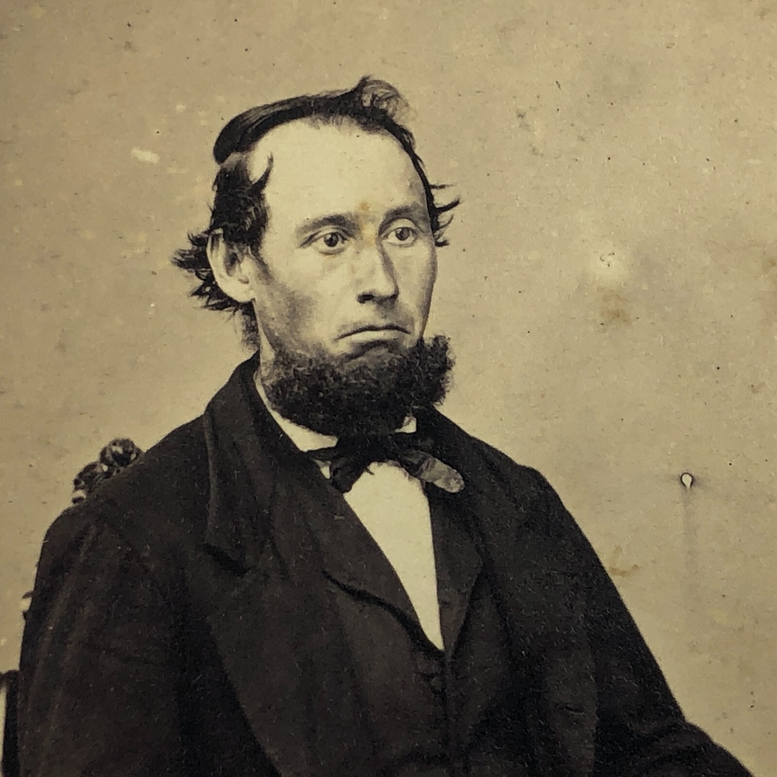 Philadelphia,PA Antique Victorian Photo CDV Sad Man Suit 1860s Chin Beard Messy 