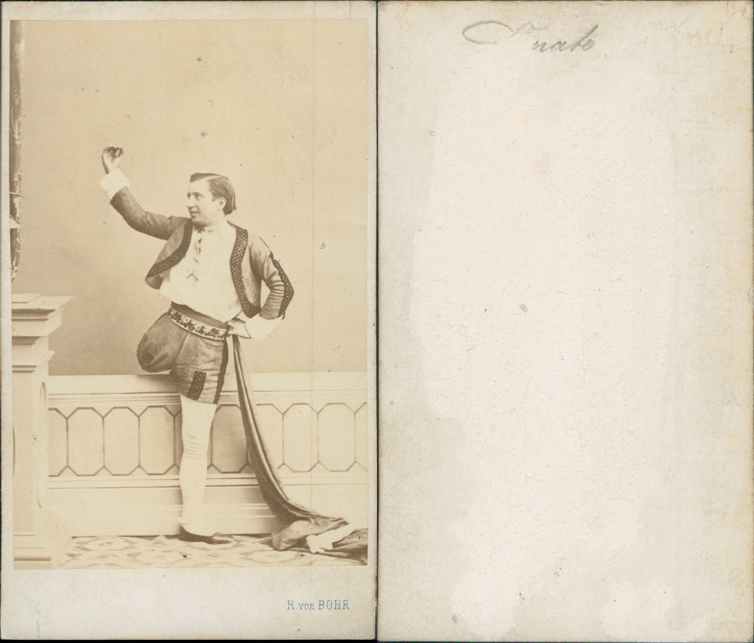 Juliano Donato, Spanish Actor, One Legged Vintage CDV Albumen Business Card