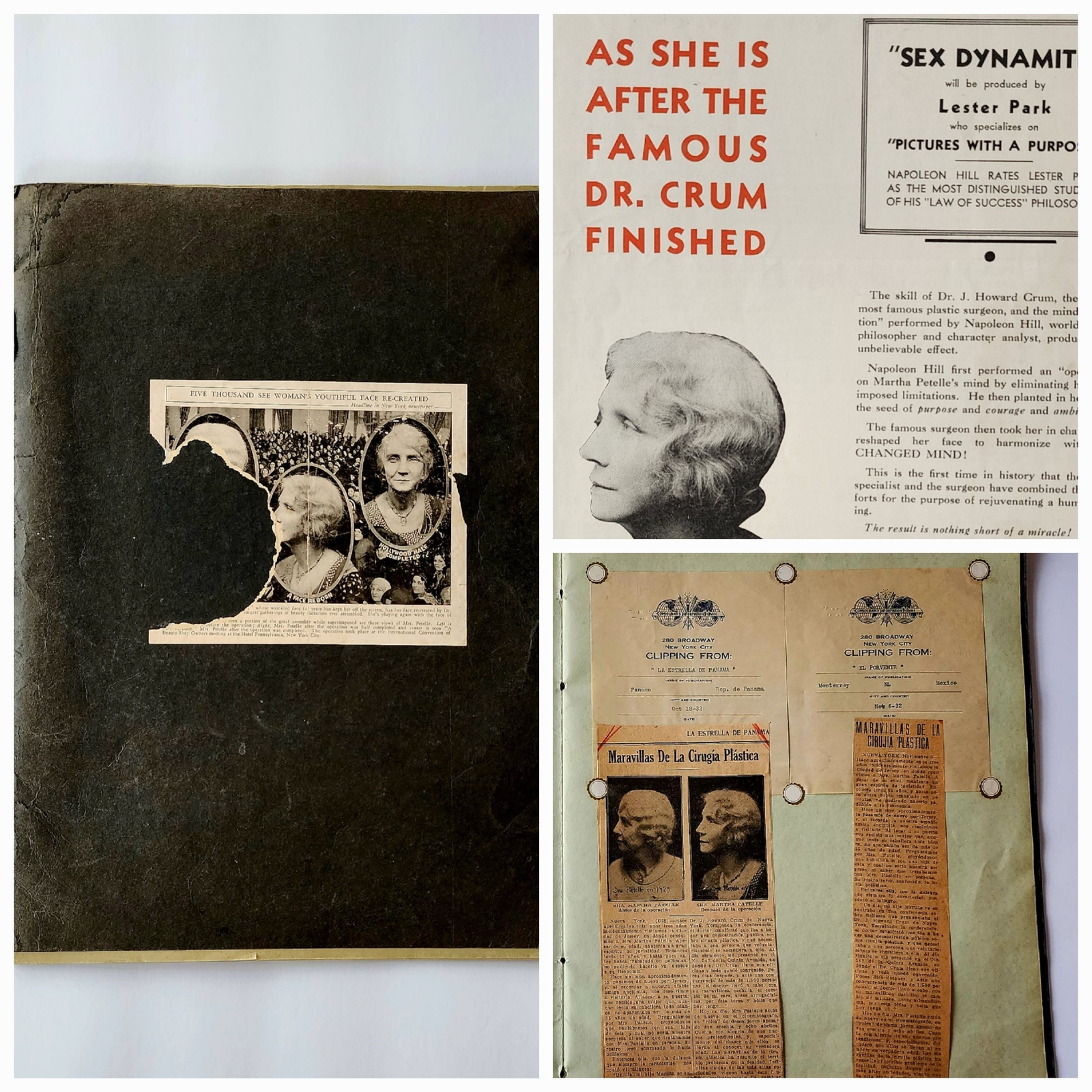 1930s Scrapbook Ephemera Hollywood Star Martha Petelle First Surgical Facelift