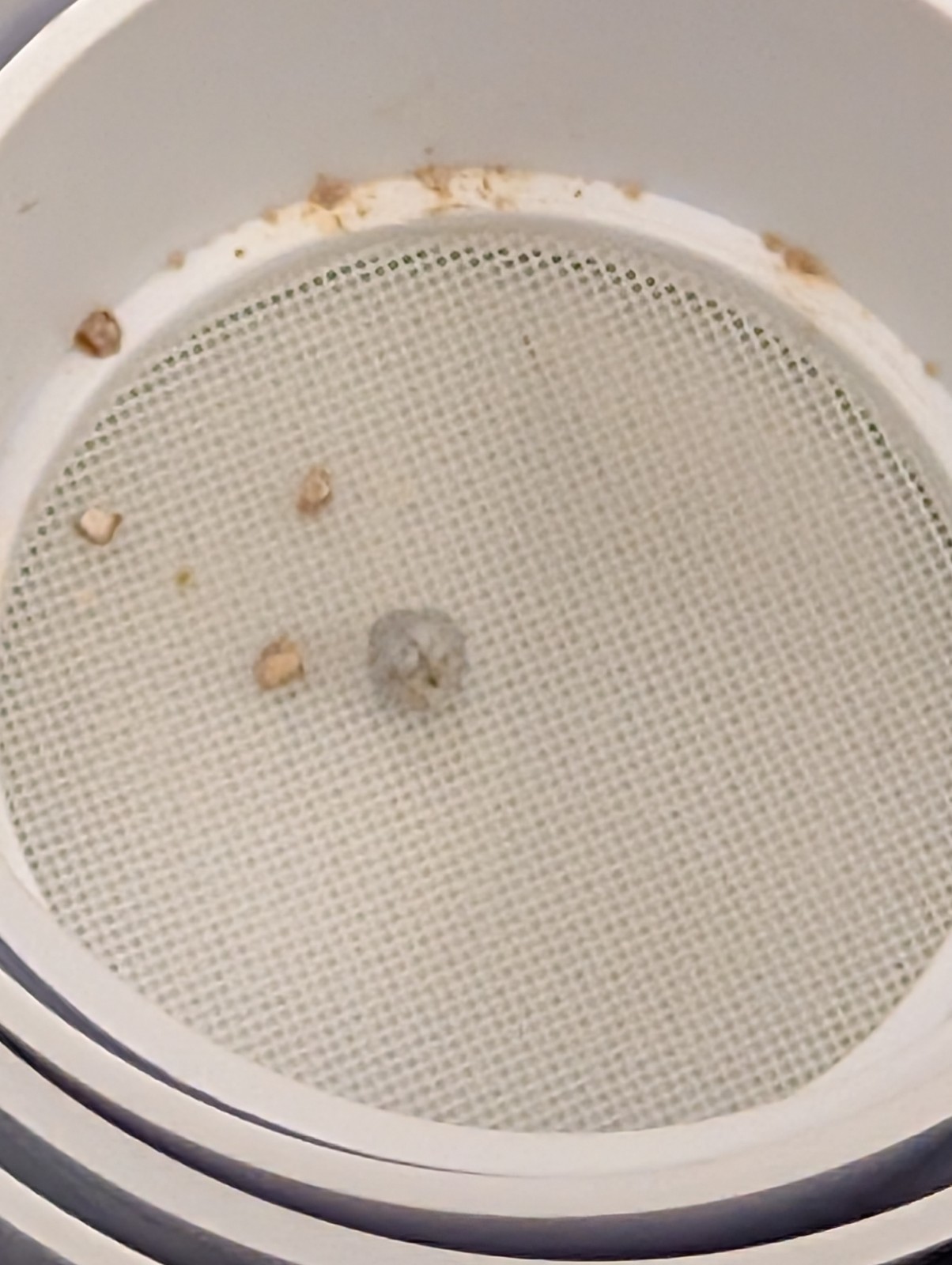 Real and Rare Kidney Stone
