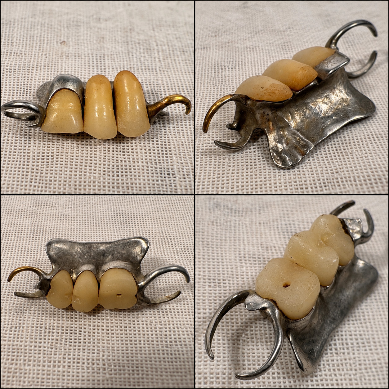 Antique 1800s Silver Partial Denture Porcelain Teeth Dental Medical Oddity