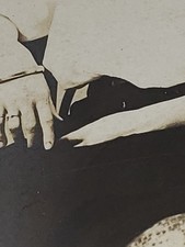 Antique Edwardian Seated Woman Portrait Left Arm Anomaly Webbed Hand RPPC Photo picture