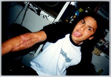 Vtg Color Snapshot Young Man Showing Forearm Burn Scar Tongue Out 1990s picture