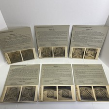 Edinburgh Stereoscopic Atlas Of Antony Cards Set Of 20 Thorax & Mediastina picture