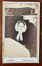 Chloe Lankton Disabled Woman 1860s CDV Photo Medical Not Post Mortem Unusual picture