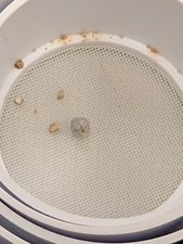 Real and Rare Kidney Stone picture